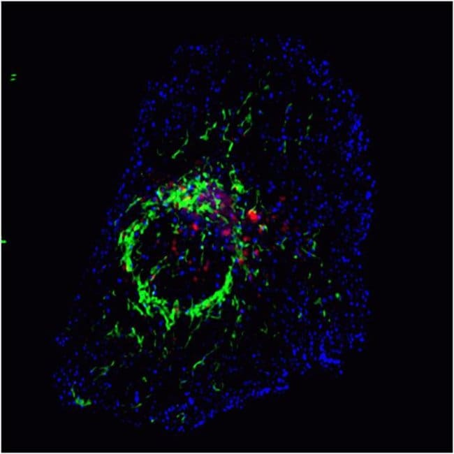 HeLa cells were co-transduced with CellLight® Late Endosmes-RFP and CellLight® Early Endosmes-GFP and incubated overnight. Following staining with MitoTracker® Deep Red, cells were imaged on a Zeiss 710 confocal microscope.